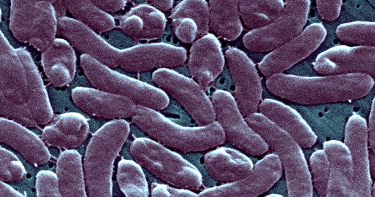 Rare, flesh-eating bacteria found in Florida including Miami-Dade, state health officials say