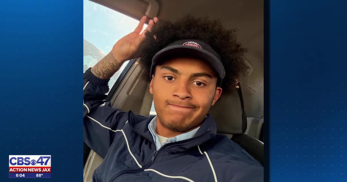 Jacksonville police investigating teen being shot in the head as accidental