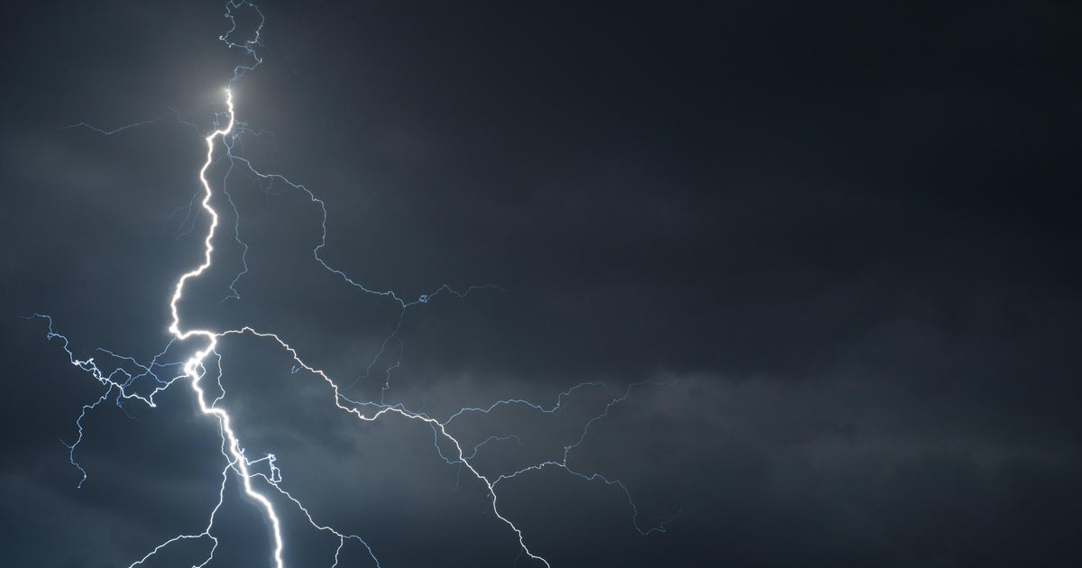 Man injured in possible lightning strike in south Miami-Dade, officials say