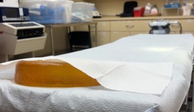 BACKYARD BOTOX: Why Florida has become a hotspot for illegal practices
