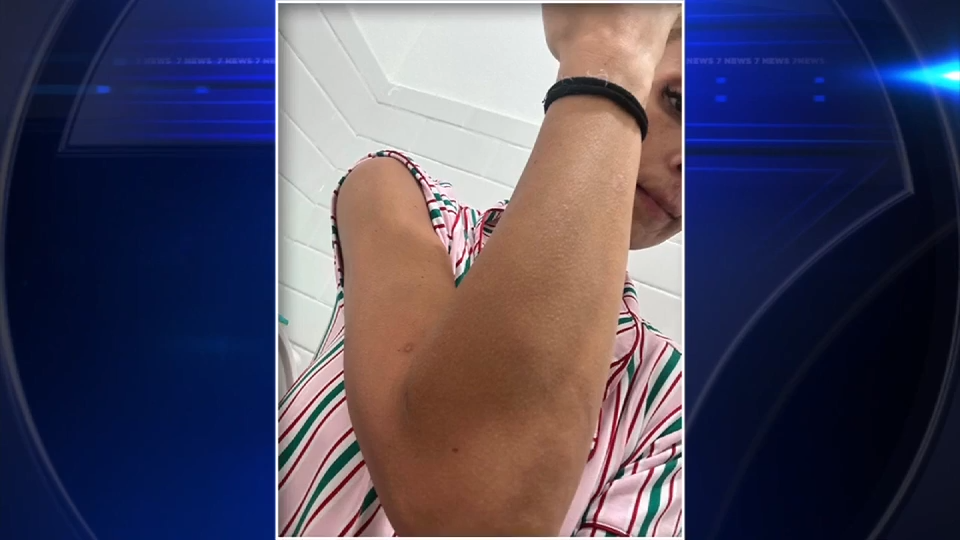 Jackson Memorial Hospital nurse sues hospital, county for $5 million after brutal attack by patient - WSVN 7News | Miami News, Weather, Sports