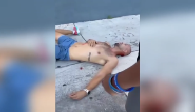 ‘I was all bit up:’ Video shows aftermath of random attack that left dog, owner with injuries in Wynwood - WSVN 7News | Miami News, Weather, Sports