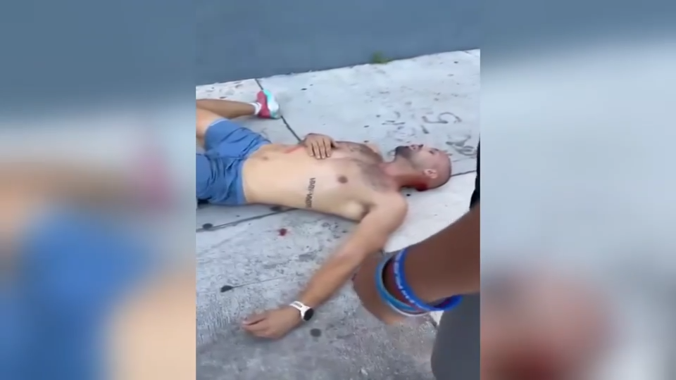 ‘I was all bit up:’ Video shows aftermath of random attack that left dog, owner with injuries in Wynwood - WSVN 7News | Miami News, Weather, Sports