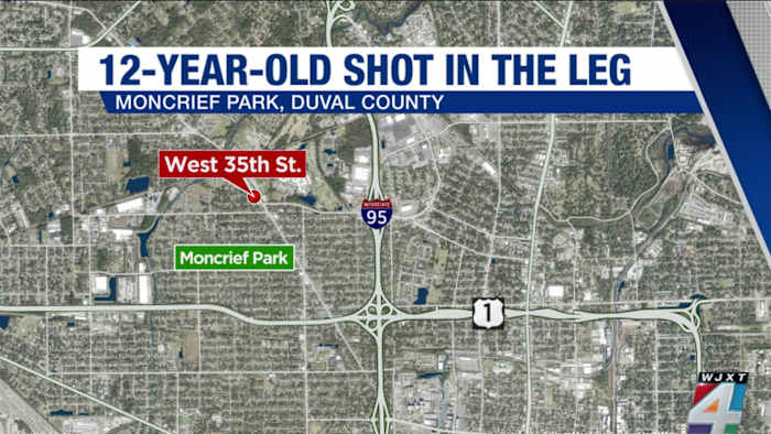 Business owner calls for change after 12-year-old boy shot in leg during large argument at Clanzel Brown Park