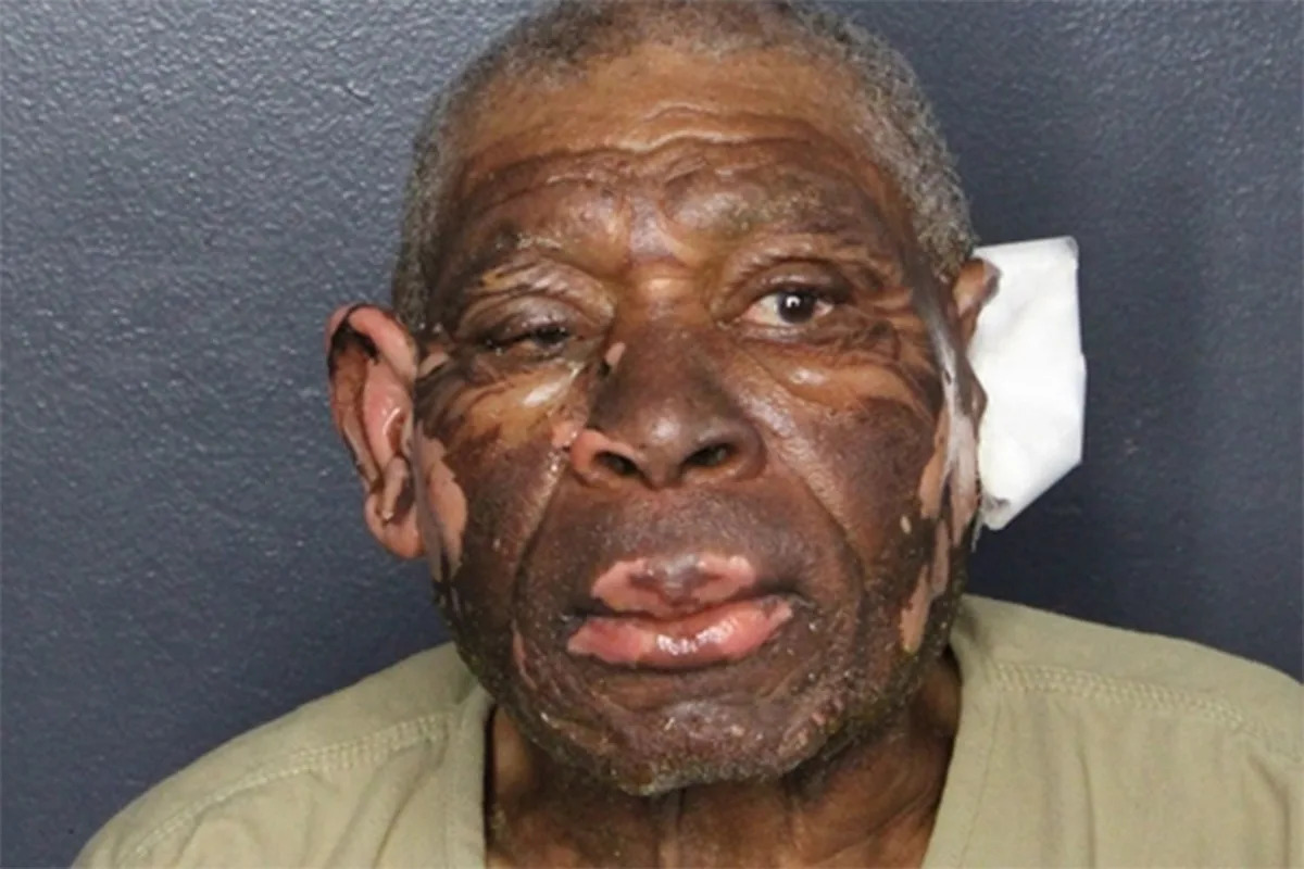 Man, 84, Allegedly Sets Car on Fire with Lover Inside After She Dumps Him
