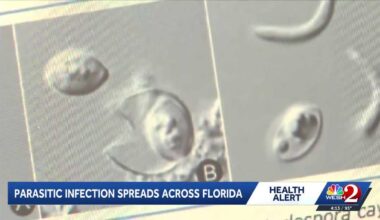 Cyclospora outbreak sickens 50 people in Florida, health officials say