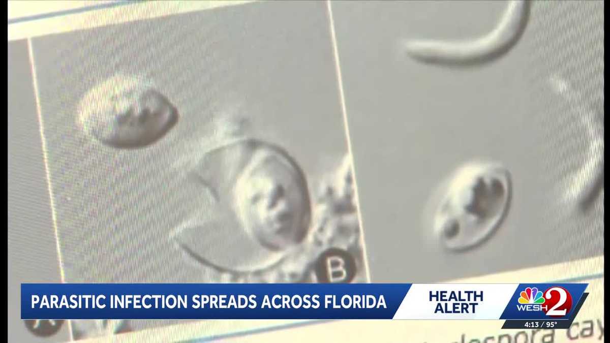 Cyclospora outbreak sickens 50 people in Florida, health officials say