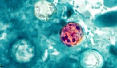 Lee County leads Florida in cases of diarrhea-causing parasite as infections rise statewide | News