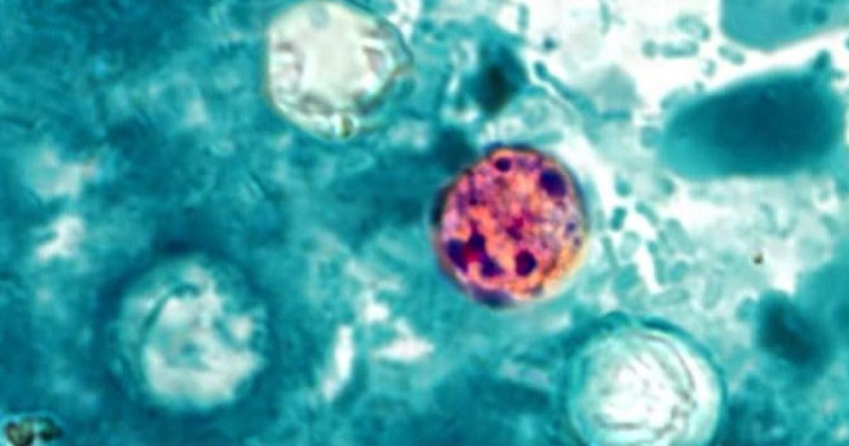 Lee County leads Florida in cases of diarrhea-causing parasite as infections rise statewide | News
