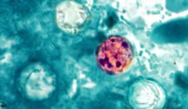 Florida cases of diarrhea-causing parasite nearly double; see numbers reported in each county | Southwest Florida