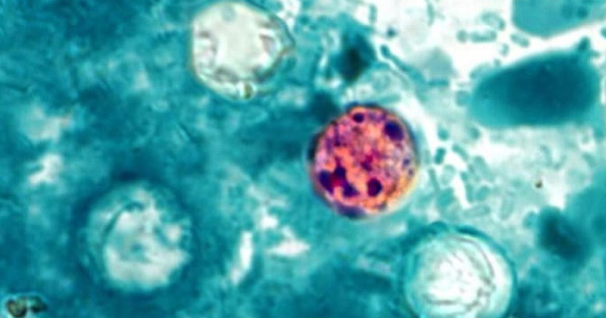 Florida cases of diarrhea-causing parasite nearly double; see numbers reported in each county | Southwest Florida