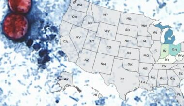 Diarrhea-causing parasite cases climb to 264 in Florida; Lee County reports 25 | News