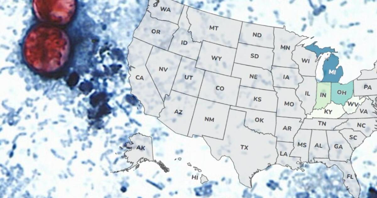 Diarrhea-causing parasite cases climb to 264 in Florida; Lee County reports 25 | News