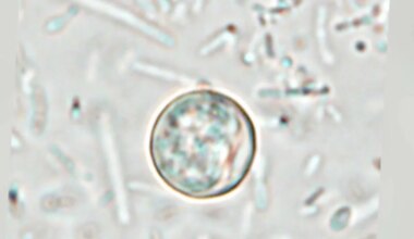 CDC probes Cyclospora outbreak tied to lettuce supplier