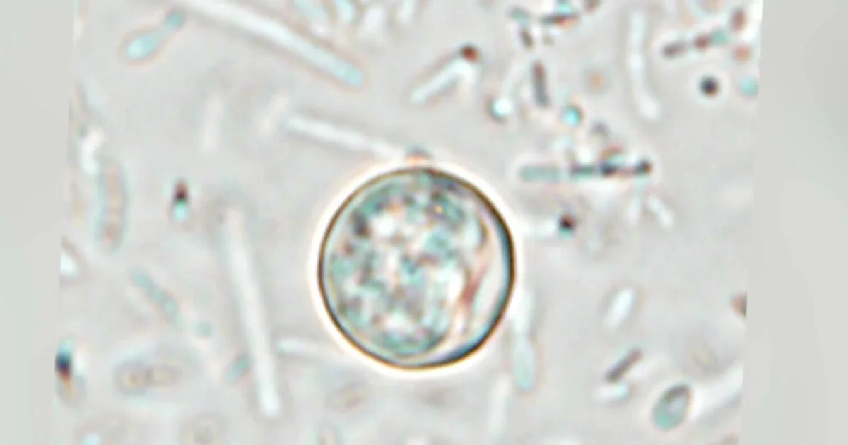 CDC probes Cyclospora outbreak tied to lettuce supplier
