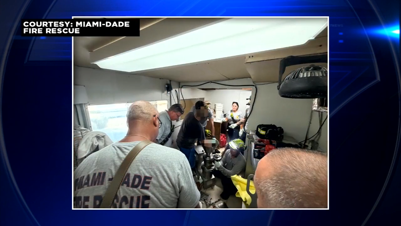 MDFR: Man hospitalized after hand caught in food processor, machine safely removed - WSVN 7News | Miami News, Weather, Sports