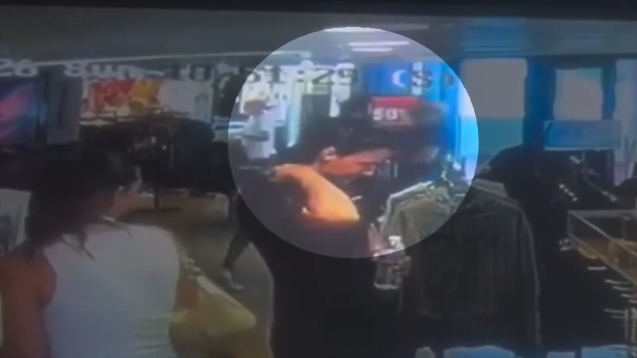 Bartender says she suffered concussion, broken tooth in violent attack at Bayside Marketplace - WSVN 7News | Miami News, Weather, Sports