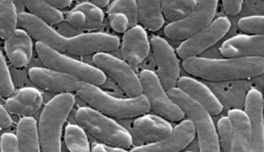 South Florida reports first Vibrio vulnificus death of year