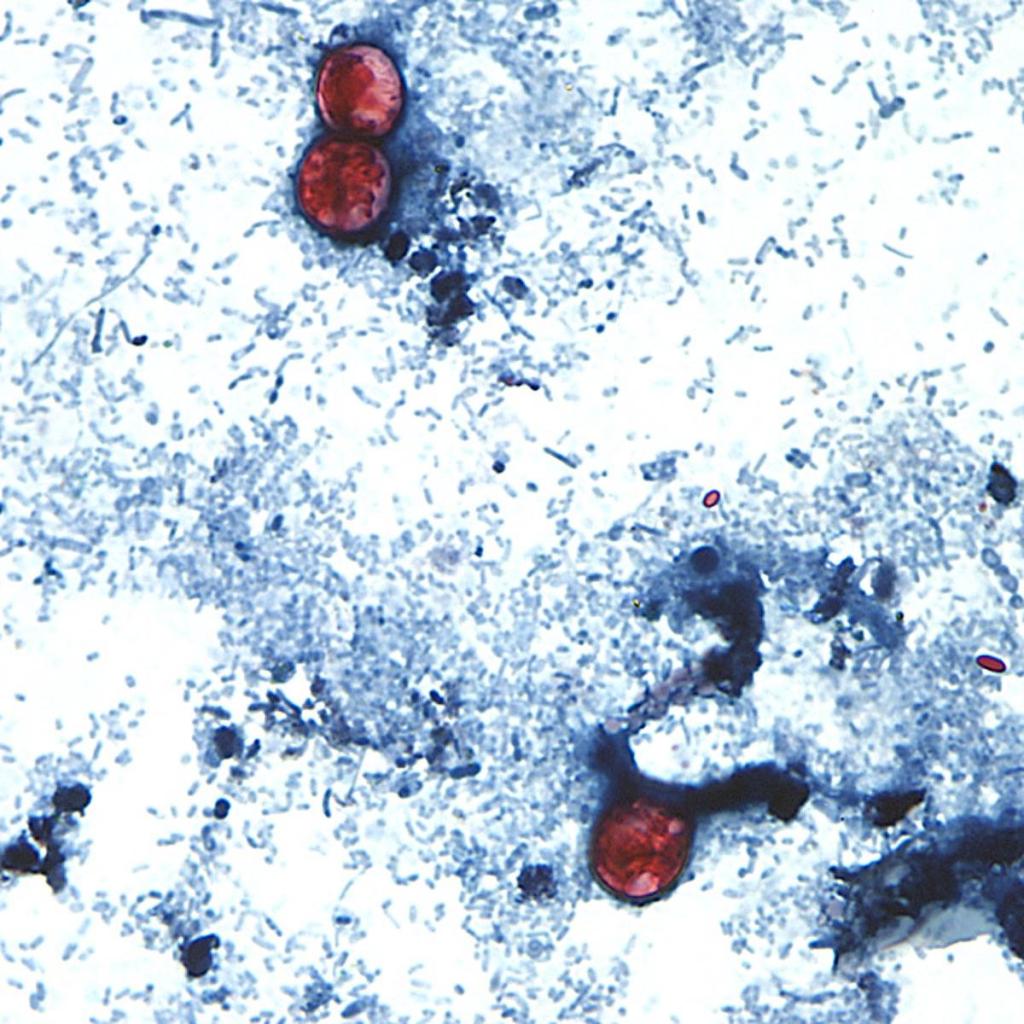 Taylor Farms recalls lettuce shipped to Florida, 26 other states over cyclospora risk