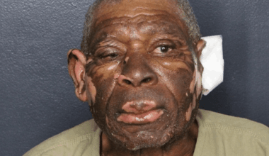 Man, 82, charged with setting fire to his ex after ending 42-year relationship