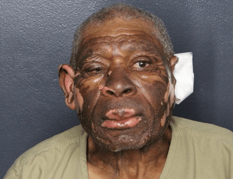Man, 82, charged with setting fire to his ex after ending 42-year relationship