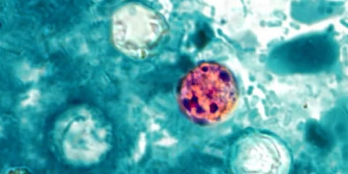 Confirmed cases of diarrhea causing parasite in North Central Florida