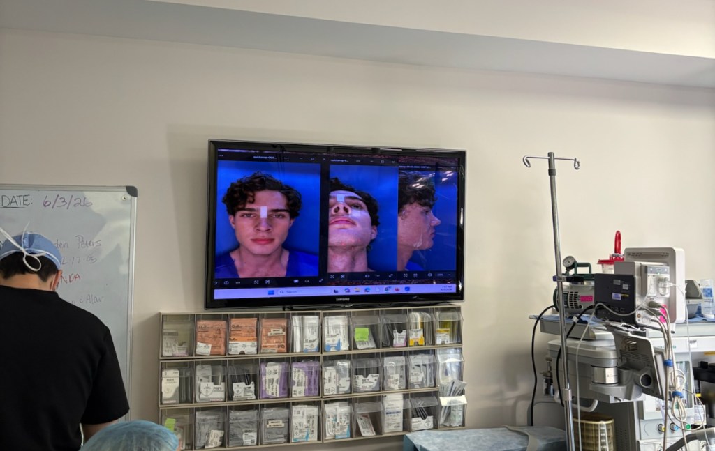 A photo of a screen inside an operating room showing a man pre-rhinoplasty.