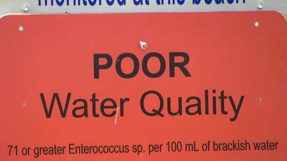 Warning signs posted for poor water quality at Tropicana Park in Cape Coral