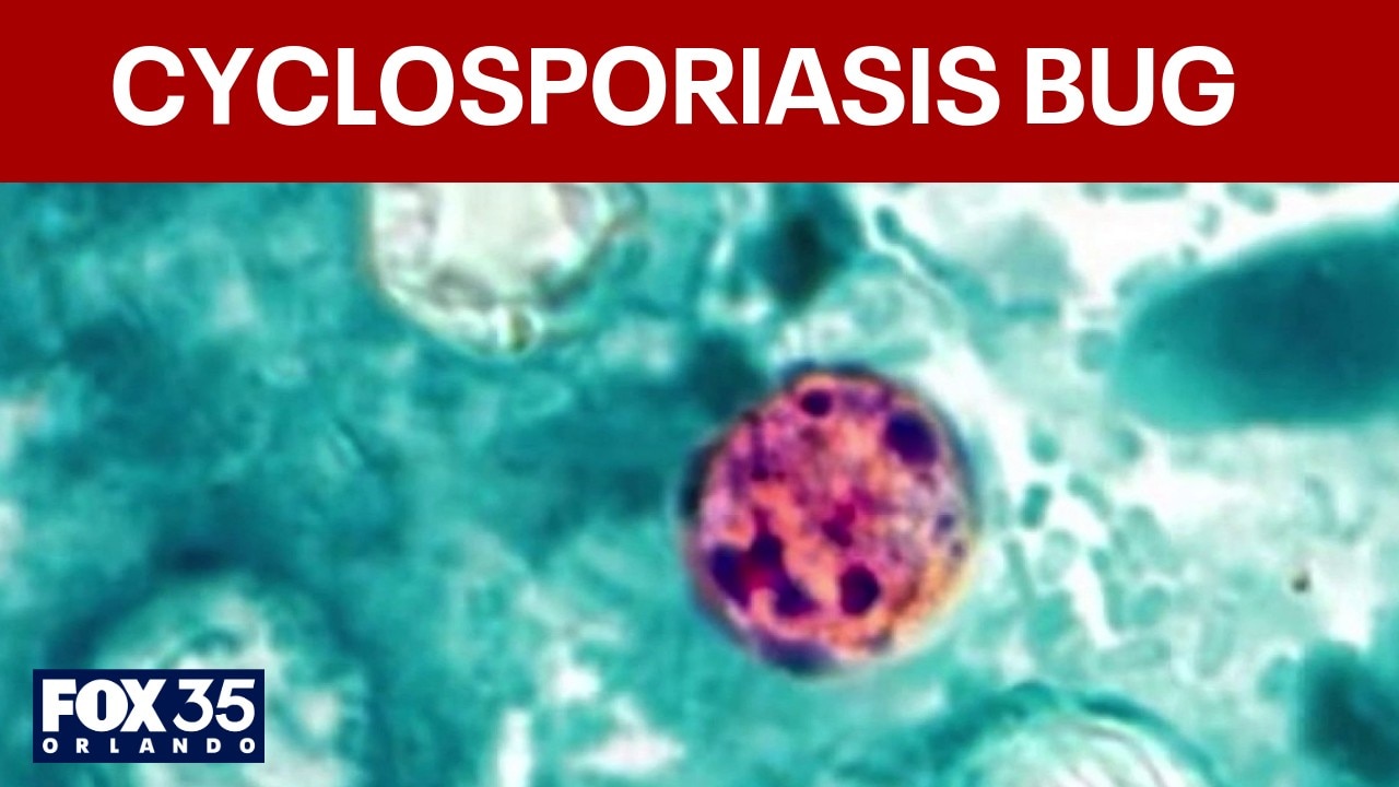 Doctor explains how to protect from Cyclosporiasis outbreak