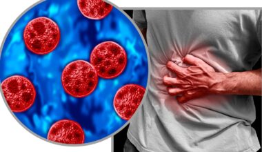 Florida is one of the states with reported cases of Cyclospora, but how many cases are in South Florida?