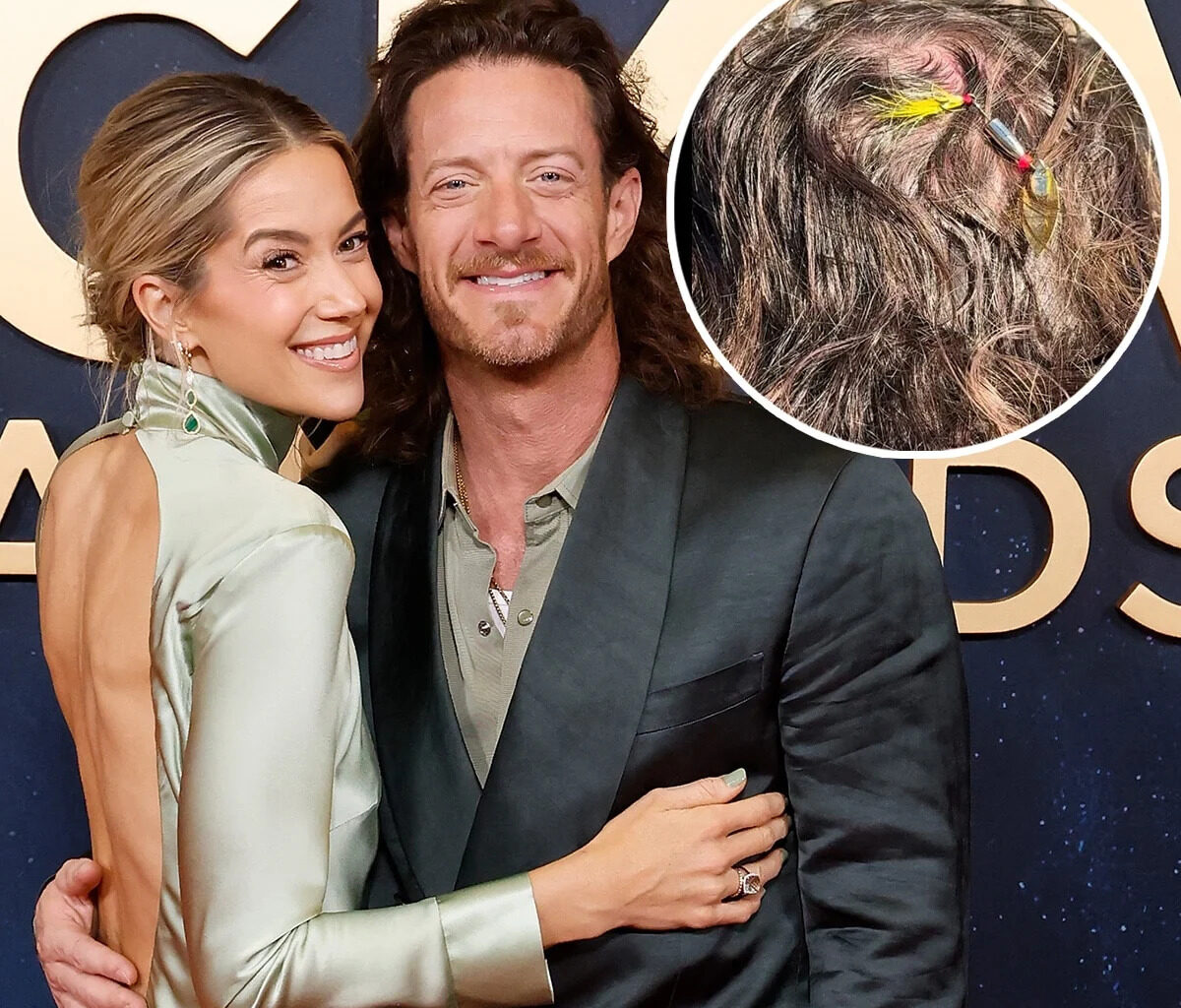 Florida Georgia Line's Tyler Hubbard Gets Fish Hook Removed From Head