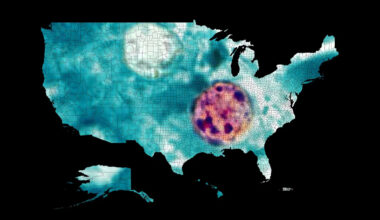 Miami-Dade County leads Florida in cyclosporiasis cases. How many