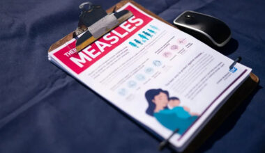 Florida ranks #5 for U.S. measles cases in 2026: CDC Report