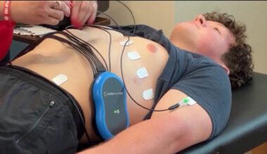 Florida now requiring heart screenings for high school athletes
