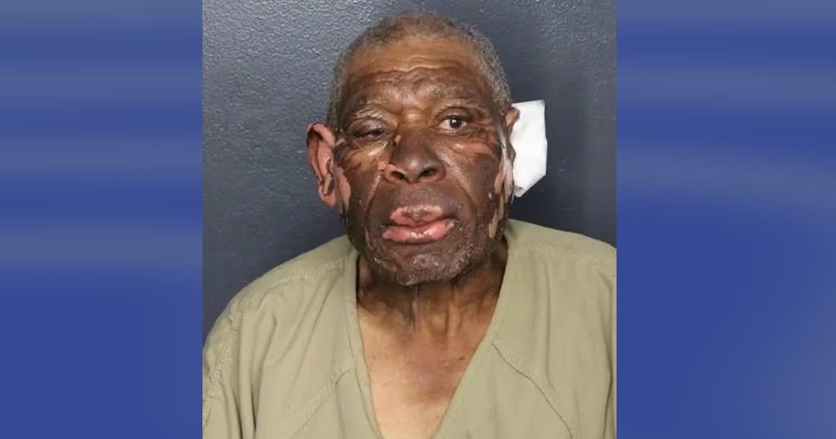 Florida man, 84, accused of setting fire to ex-girlfriend after ending 42-year relationship – WSB-TV Channel 2