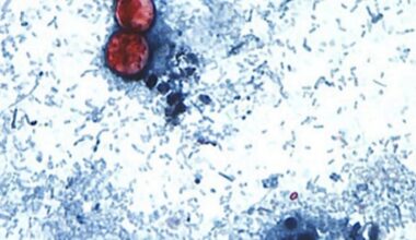 Florida among states reporting cyclosporiasis cases as CDC tracks nationwide increase – Action News Jax