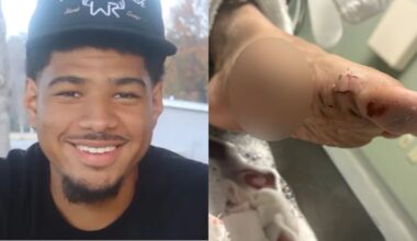 Metro Atlanta man attacked by shark protecting fiancée on Florida beach – WSB-TV Channel 2