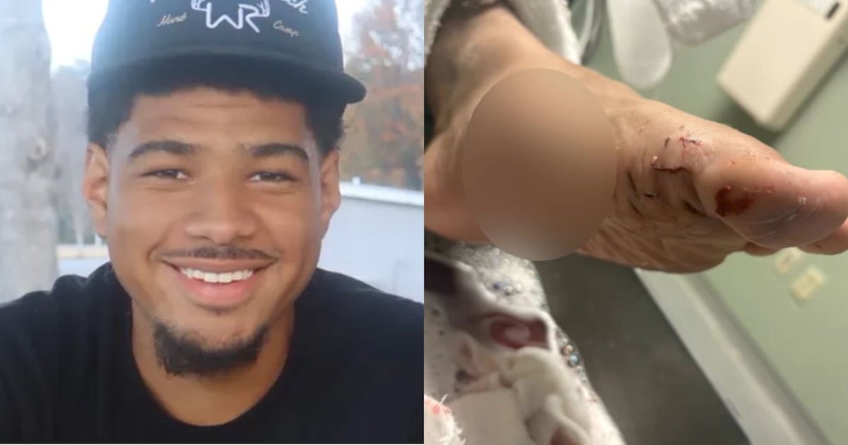 Metro Atlanta man attacked by shark protecting fiancée on Florida beach – WSB-TV Channel 2