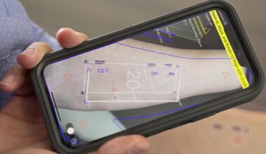 AI could help patients identify skin reactions using phone photos