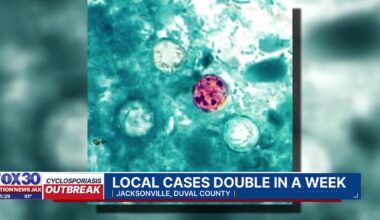 Cyclosporiasis cases rise to 96 across Florida