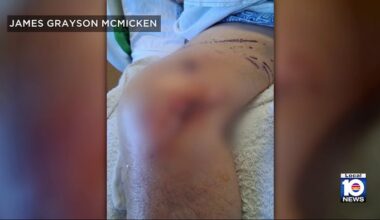 Florida man survives alligator attack during backyard fishing trip