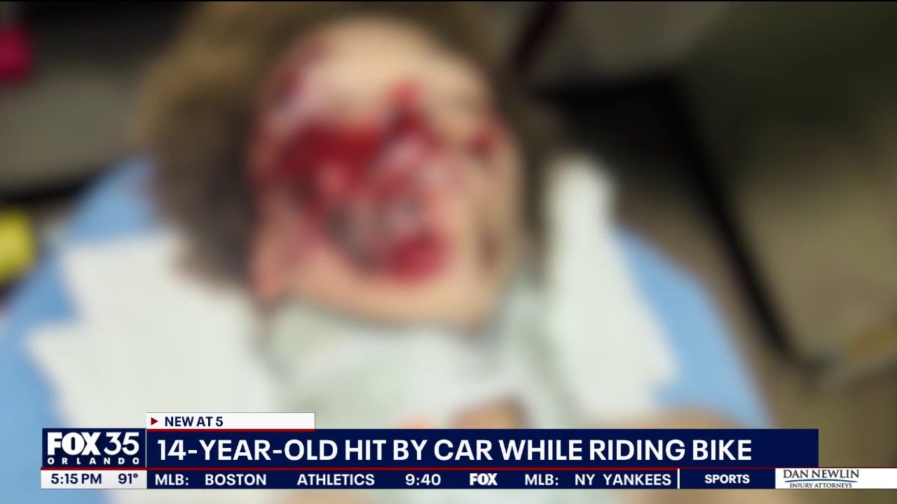 Helmet credited with saving teen bicyclist struck by car