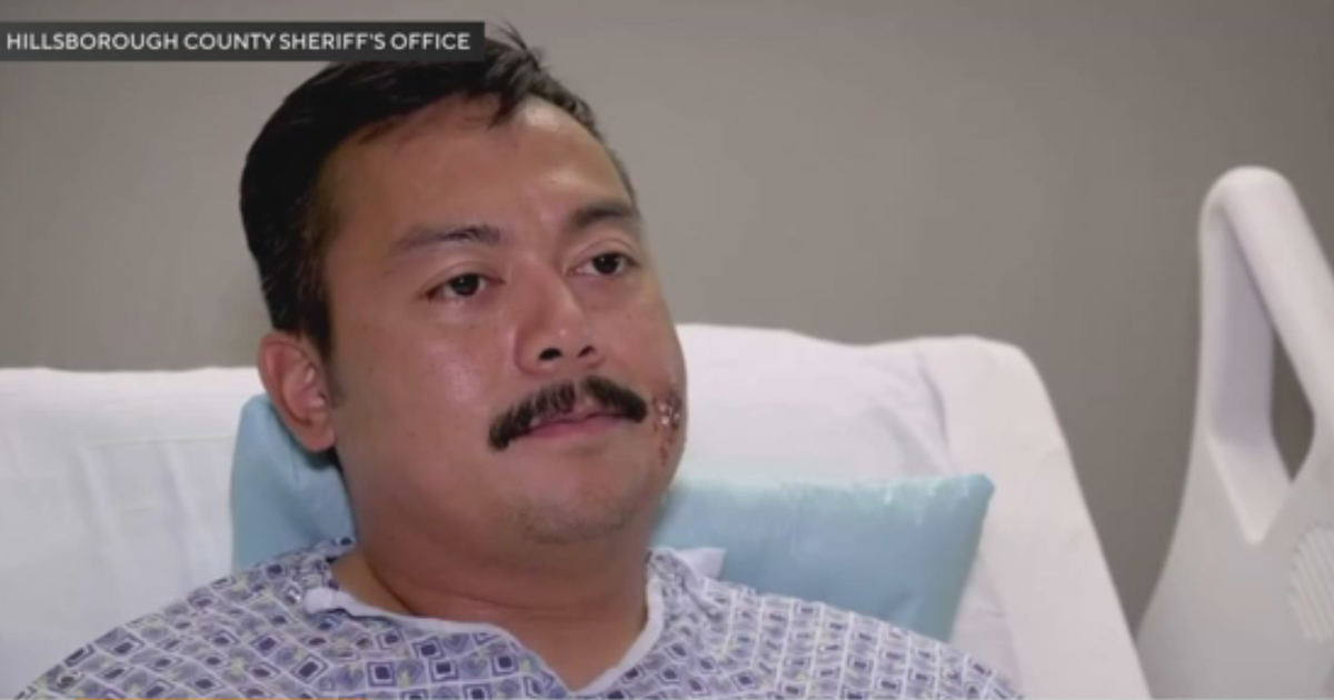 Florida deputy recovering at home nearly a week after being shot in the face during reported ambush