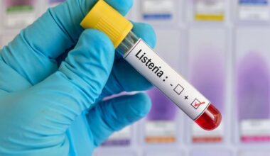 Listeria Outbreak Linked To Tampa Restaurant: FL Department Of Health