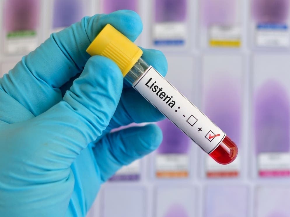Listeria Outbreak Linked To Tampa Restaurant: FL Department Of Health