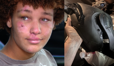 'Just got smacked': Florida 14-year-old credits helmet for saving life in crash