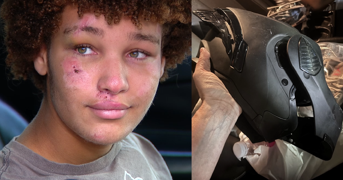 'Just got smacked': Florida 14-year-old credits helmet for saving life in crash