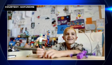 Boy recovering at Holtz Children’s Hospital after being attacked by pack of dogs in the Bahamas - WSVN 7News | Miami News, Weather, Sports