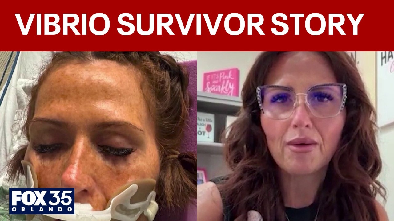 'Flesh-eating' bacteria survivor issues warning after 14 cases in Florida in 2026