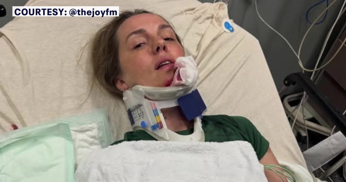 ‘You’re talking life and death’: Bay Area radio host warns parents after e-bike crash